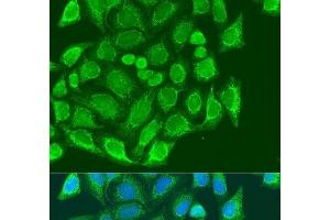 Immunofluorescence analysis of U2OS cells using MTX1 Polyclonal Antibody at dilution of 1:100.