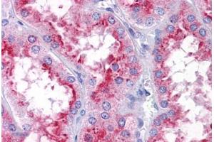 Human Kidney: Formalin-Fixed, Paraffin-Embedded (FFPE) (PICALM 抗体  (N-Term))