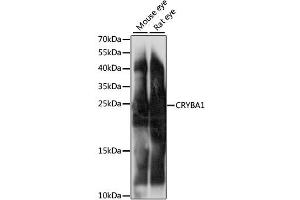 Western blot analysis of extracts of various cell lines, using CRYBA1 antibody (ABIN6291831) at 1:1000 dilution. (CRYBA1 抗体)