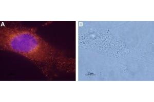 Expression of Bombesin receptor 1 in a human breast cancer cell line - Immunocytochemical staining of paraformaldehyde-fixed and permeabilized mammary gland adenocarcinoma MDA-MB-231. (NMBR 抗体  (3rd Intracellular Loop))