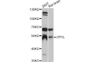 Western blot analysis of extracts of various cell lines, using CPVL antibody (ABIN5997512) at 1:3000 dilution. (CPVL 抗体)