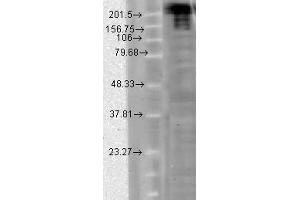 Image no. 1 for anti-Sodium Channel, Voltage-Gated, Type IX, alpha Subunit (SCN9A) (AA 1751-1946) antibody (ABIN466986) (SCN9A 抗体  (AA 1751-1946))