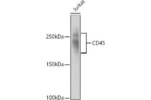 Western blot analysis of extracts of Jurkat cells, using CD45 antibody (ABIN3022953, ABIN3022954, ABIN3022955, ABIN1513451 and ABIN6219315) at 1:1000 dilution.