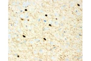 IHC-P: Calretinin antibody testing of mouse brain tissue (Calretinin 抗体  (C-Term))