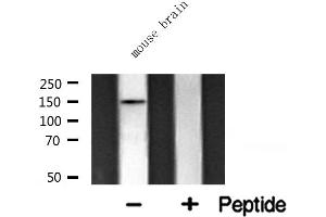 Western Blotting (WB) image for anti-Chromatin Assembly Factor 1, Subunit A (p150) (CHAF1A) (Internal Region) antibody (ABIN6257706)