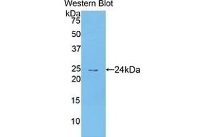 Detection of Recombinant TECK, Human using Polyclonal Antibody to Thymus Expressed Chemokine (TECK) (CCL25 抗体  (AA 24-150))