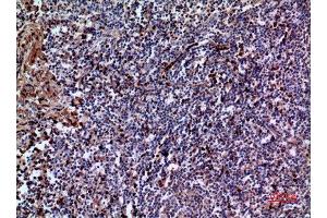 Immunohistochemistry (IHC) image for anti-Interleukin 28 (IL28) (C-Term) antibody (ABIN3181017)