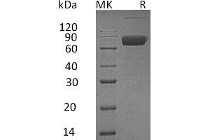 IL10RB Protein (Fc Tag)