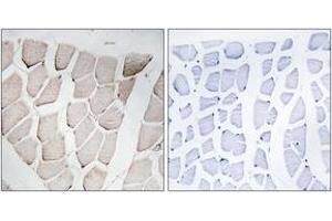 Immunohistochemistry analysis of paraffin-embedded human skeletal muscle, using MYOM1 Antibody. (Myomesin 1 抗体  (AA 824-873))