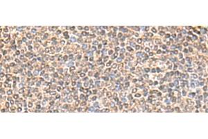 Immunohistochemistry of paraffin-embedded Human tonsil tissue using IQCD Polyclonal Antibody at dilution of 1:60(x200) (IQCD 抗体)