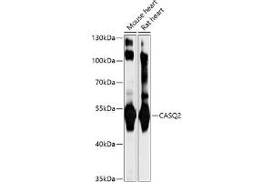 Western blot analysis of extracts of various cell lines, using C antibody (ABIN7266047) at 1:1000 dilution. (CASQ2 抗体  (AA 20-399))