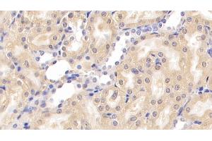 Detection of NPHN in Rat Kidney Tissue using Monoclonal Antibody to Nephrin (NPHN) (Nephrin 抗体  (AA 39-106))