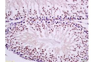 Immunohistochemistry (Paraffin-embedded Sections) (IHC (p)) image for anti-Protein Kinase C, epsilon (PRKCE) (AA 631-737) antibody (ABIN679538)