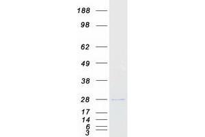 Western Blotting (WB) image for Proteasome (Prosome, Macropain) Subunit, beta Type, 5 (PSMB5) (Transcript Variant 1) protein (Myc-DYKDDDDK Tag) (ABIN2729934)