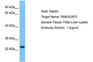 Host: Rabbit Target Name: RAB3GAP2 Sample Type: Fetal Liver lysates Antibody Dilution: 1. (RAB3GAP2 抗体  (Middle Region))