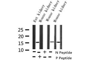 Western blot analysis of Phospho-Survivin (Thr117) expression in various lysates