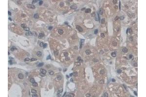 DAB staining on IHC-P; Samples: Human Stomach Tissue (POMT1 抗体  (AA 318-513))