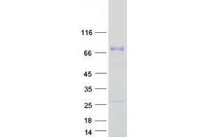 Western Blotting (WB) image for Acyl-CoA Binding Domain Containing 5 (ACBD5) (Transcript Variant 1) protein (Myc-DYKDDDDK Tag) (ABIN2714312)