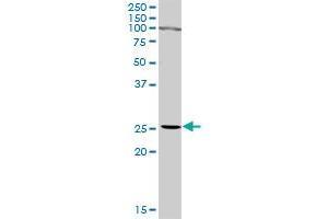 IFNA2 MaxPab rabbit polyclonal antibody. (IFNA2 抗体  (AA 1-188))