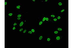 Immunofluorescence staining of Hela cells with ABIN7127289 at 1:34,counter-stained with DAPI. (Recombinant HIST1H3A 抗体  (H3K4me2))