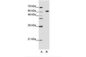 Image no. 2 for anti-Glucocorticoid Modulatory Element Binding Protein 2 (GMEB2) (C-Term) antibody (ABIN202723) (GMEB2 抗体  (C-Term))