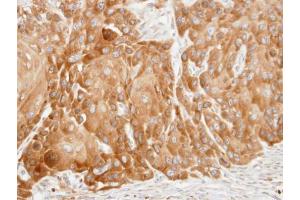 IHC-P Image Immunohistochemical analysis of paraffin-embedded SCC15 xenograft, using VDP/p115, antibody at 1:100 dilution. (USO1 抗体  (C-Term))