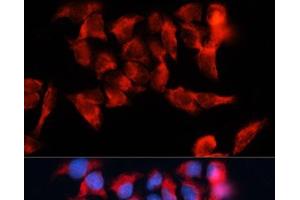 Immunofluorescence analysis of HeLa cells using BST2 Polyclonal Antibody at dilution of 1:100. (BST2 抗体)