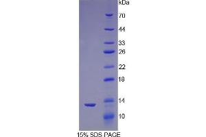 SDS-PAGE analysis of Mouse Nephrin Protein. (Nephrin 蛋白)