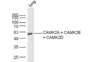 Mouse lung lysates probed with CAMK2A + CAMK2B + CAMK2D Polyclonal Antibody, Unconjugated  at 1:300 dilution and 4˚C overnight incubation. (CAMK2B 抗体  (AA 1-100))