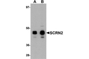 Western blot analysis of SCRN2 in 293 cell tissue lysate with SCRN2 antibody at (A) 0. (SCRN2 抗体  (C-Term))