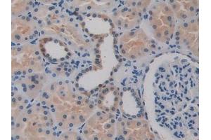 Immunohistochemistry (IHC) image for anti-Biglycan (BGN) (AA 230-366) antibody (ABIN7438334)