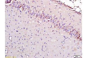 Formalin-fixed and paraffin embedded rat brain labeled with Rabbit Anti-AIF Polyclonal Antibody, Unconjugated  1:300 followed by conjugation to the secondary antibody and DAB staining