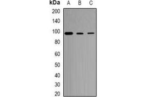 Western blot analysis of CD281 expression in U251 (A), mouse spleen (B), mouse liver (C) whole cell lysates. (TLR1 抗体)
