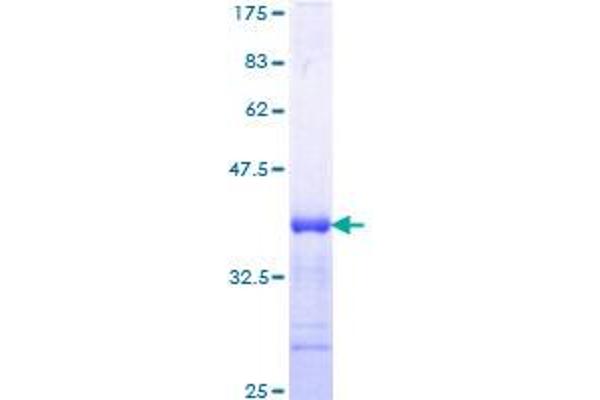 TGFBR1 Protein (AA 30-125) (GST tag)