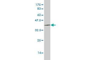Western Blot detection against Immunogen (35. (LHX6 抗体  (AA 274-363))