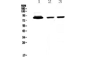 Western blot analysis of Lactoferrin using anti-Lactoferrin antibody . (Lactoferrin 抗体  (AA 529-710))