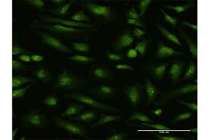 Immunofluorescence of monoclonal antibody to MTA1 on HeLa cell. (MTA1 抗体  (AA 601-700))