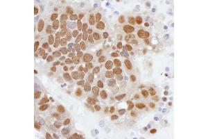 Immunohistochemistry (IHC) image for anti-Phosphate Cytidylyltransferase 1, Choline, alpha (PCYT1A) (AA 317-367) antibody (ABIN7453442) (PCYT1A 抗体  (AA 317-367))