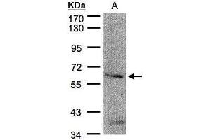 WB Image Sample(30 μg of whole cell lysate) A:H1299 7. (FANCG 抗体  (Center))