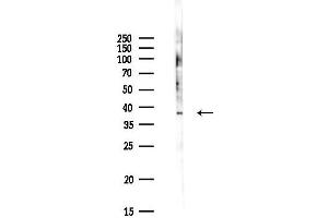 anti-Ubiquinol-Cytochrome C Reductase Complex Chaperone (UQCC) antibody