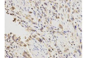 Immunohistochemistry (IHC) image for anti-Placenta Growth Factor (PGF) antibody (ABIN1874109) (PLGF 抗体)