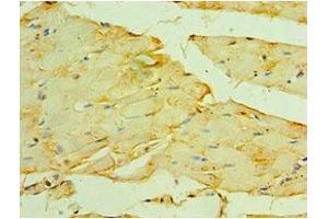 Immunohistochemistry of paraffin-embedded human skeletal muscle tissue using ABIN7160621 at dilution of 1:100 (Myotilin 抗体  (AA 443-498))