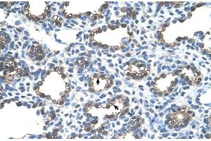Human Lung (Erythrocyte Ankyrin 抗体  (C-Term))
