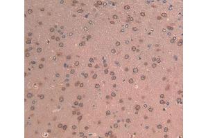 Used in DAB staining on fromalin fixed paraffin- embedded brain tissue (LAMB2 抗体  (AA 75-223))