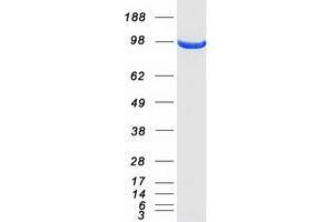 Western Blotting (WB) image for Ubiquitin Specific Peptidase 5 (USP5) (Transcript Variant 2) protein (Myc-DYKDDDDK Tag) (ABIN2735133)