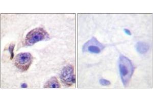 Immunohistochemistry analysis of paraffin-embedded human brain, using FAK (Phospho-Tyr407) Antibody. (FAK 抗体  (pTyr407))