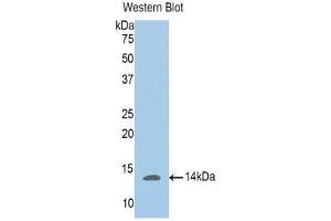 Western Blotting (WB) image for anti-Phosphoglucomutase 5 (PGM5) (AA 182-296) antibody (ABIN1176480) (Phosphoglucomutase 5 抗体  (AA 182-296))