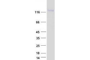 Validation with Western Blot