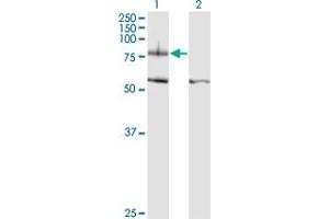 Western Blot analysis of ITGB8 expression in transfected 293T cell line by ITGB8 monoclonal antibody (M01), clone 2B4. (ITGB8 抗体  (AA 392-503))