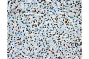 Immunohistochemical staining of paraffin-embedded Kidney tissue using anti-PRKG1 mouse monoclonal antibody. (PRKG1 抗体)